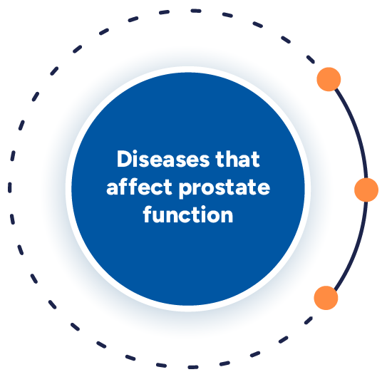 Infographic illustrating common diseases affecting the prostate, including prostate cancer, benign prostatic hyperplasia (BPH), and prostatitis, with arrows connecting to a central circle on prostate functions, in soft blue tones for gentle awareness.